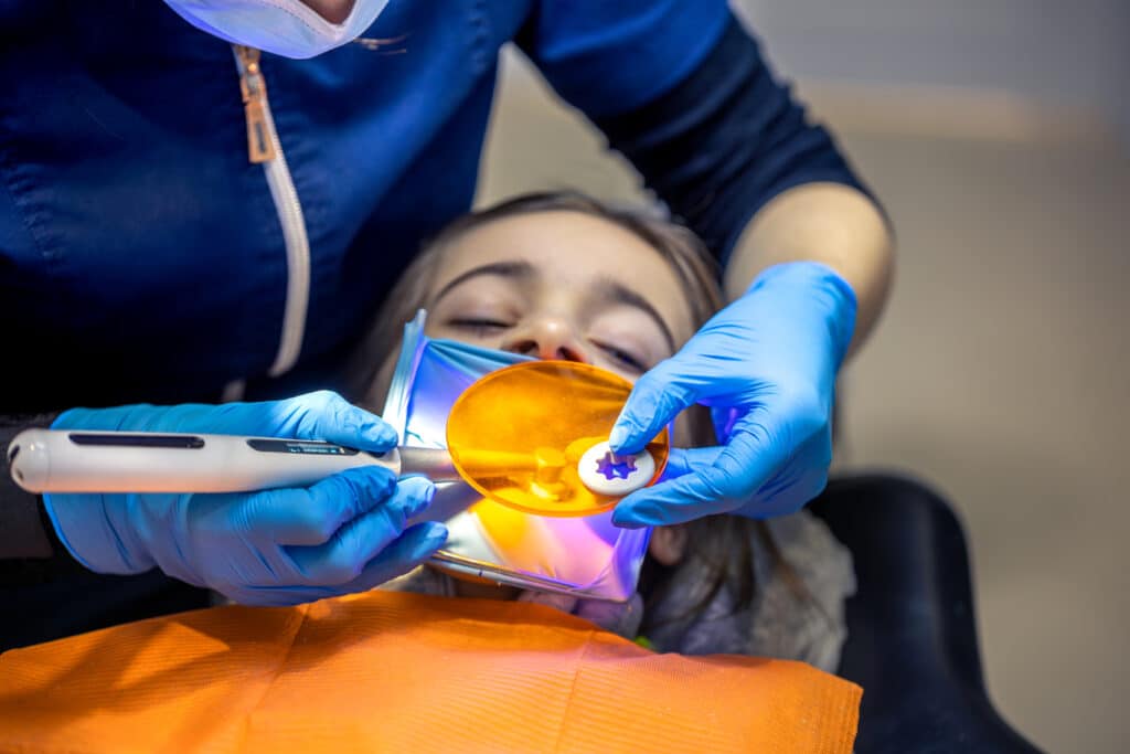 Dental fillings procedure with UV curing light