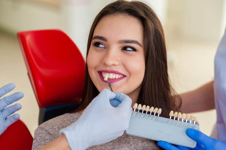 Dental veneers before and after