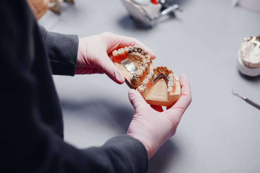Difference between traditional and implant-supported dentures