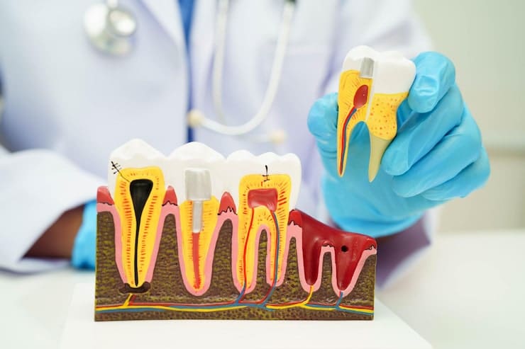 Gum disease prevention tips and oral care