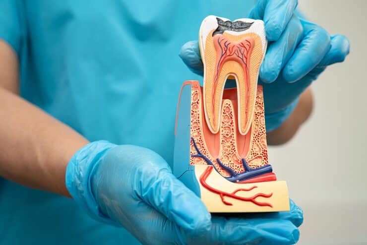 Gum disease treatment at North Pointe Dental Center