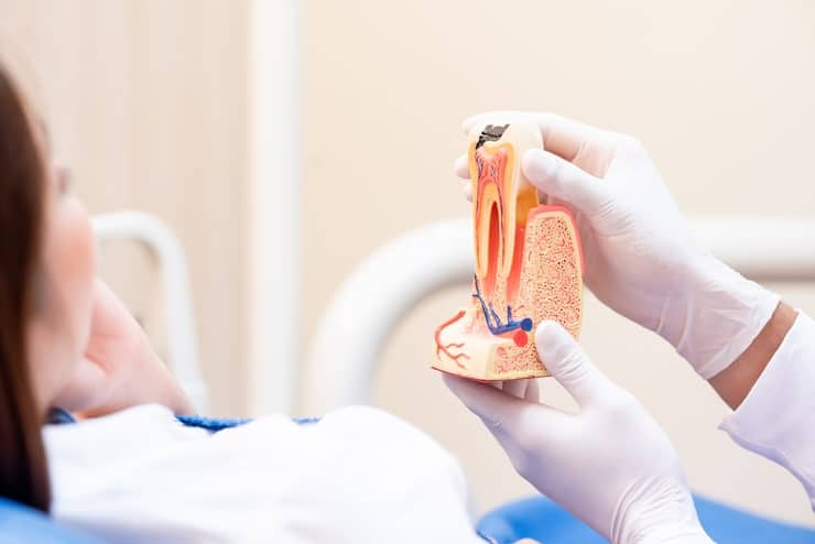 Common root canal myths debunked