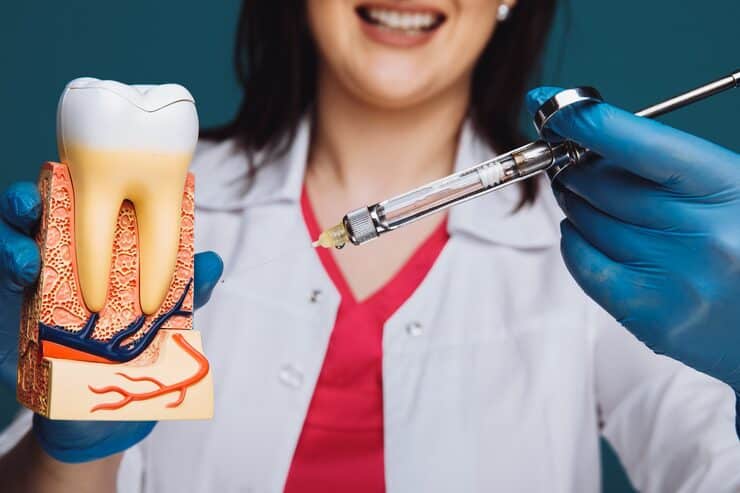 Root canal process step-by-step